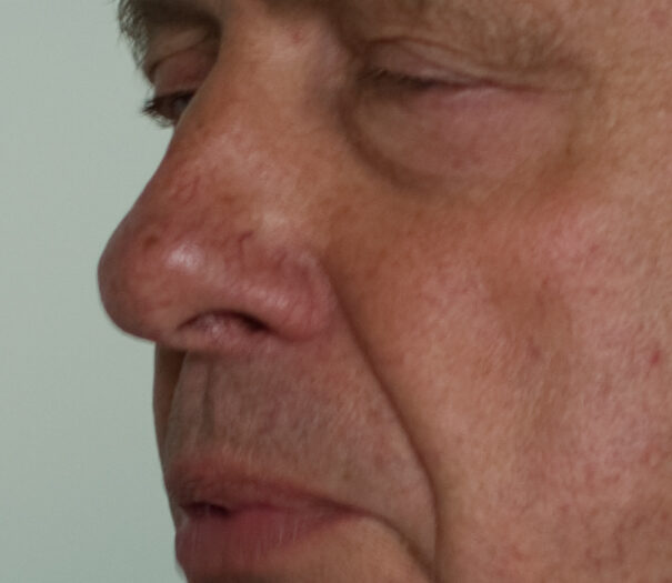Iso100-31